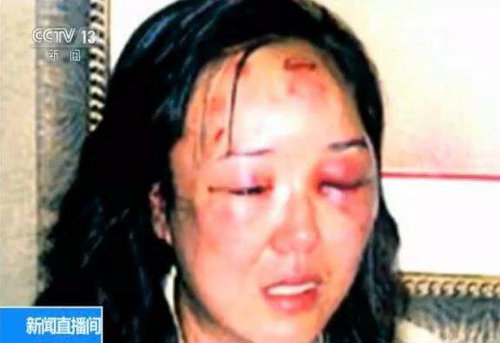 赵燕女士当时被打后的照片